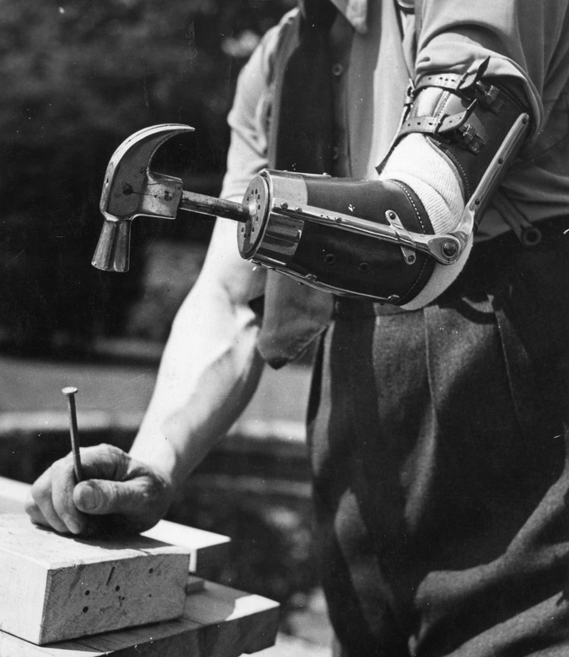 Illustration for article titled The History of Prosthetics Reveals a Long Tradition of Human Cyborgs